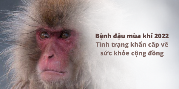 Bệnh đậu mùa khỉ được công bố là tình trạng khẩn cấp về sức khỏe cộng đồng được quốc tế quan tâm